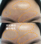 21支KOIKKI安瓶，用完感觉皮肤自带钻石高光